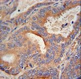 GLB1L2 Antibody (aa479-507)