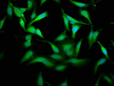 PKM / Pyruvate Kinase, Muscle Antibody
