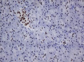 ZSCAN18 / ZNF447 Antibody (clone OTI2A9)