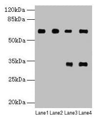 PGM1 / Phosphoglucomutase 1 Antibody (aa1-562)