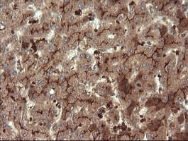 MME / CD10 Antibody (clone OTI3D11)