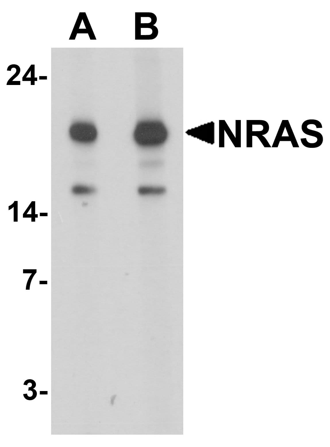Polyclonal Rabbit anti-Human NRAS / N-ras Antibody (IHC, WB)