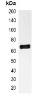 RELA / NFKB p65 Antibody