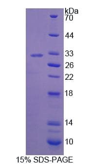 Mouse BCOR Protein (Recombinant His-T7)