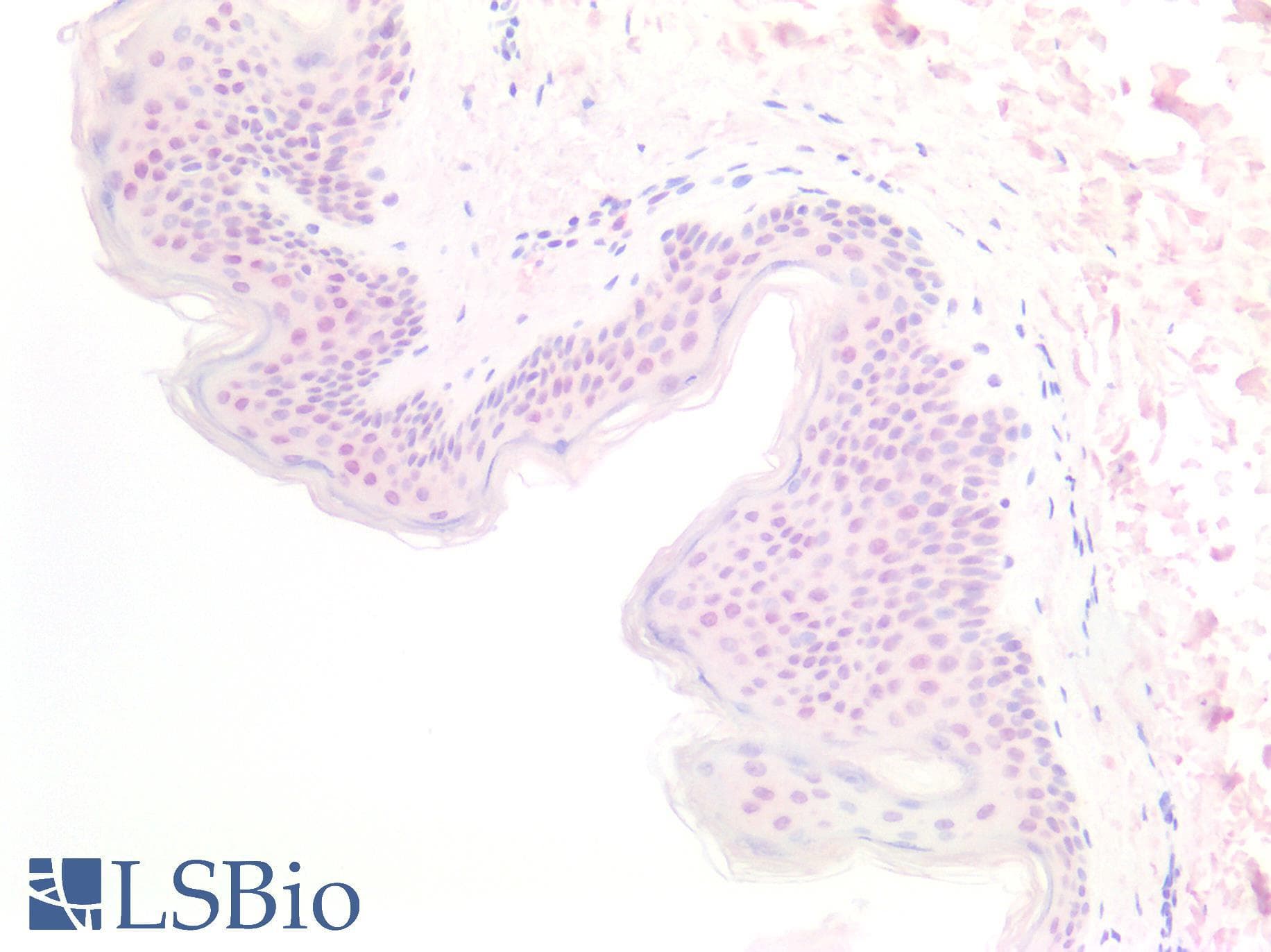 PathPlus™ MEN1 / Menin Antibody (aa575-C-term)