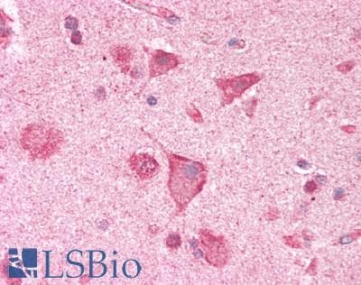 IHC-plus™ Polyclonal Rabbit anti-Human CACNA1E / Cav2.3 Antibody (IHC, WB)