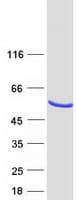 Human TMED8 Protein (Recombinant Myc-DDK (Flag))