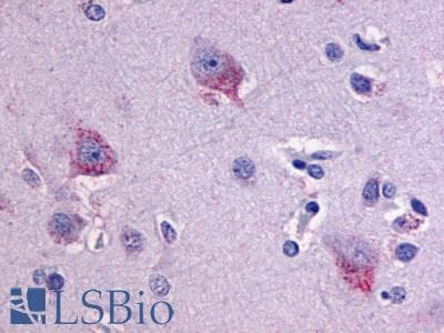 IHC-plus™ Polyclonal Rabbit anti-Human ADGRL1 / LPHN1 Antibody (C-Terminus, IHC)