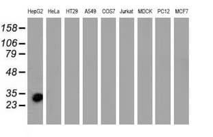 SULT1A1 / Sulfotransferase 1A1 Antibody (clone OTI9D10)