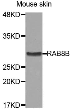 RAB8B Antibody