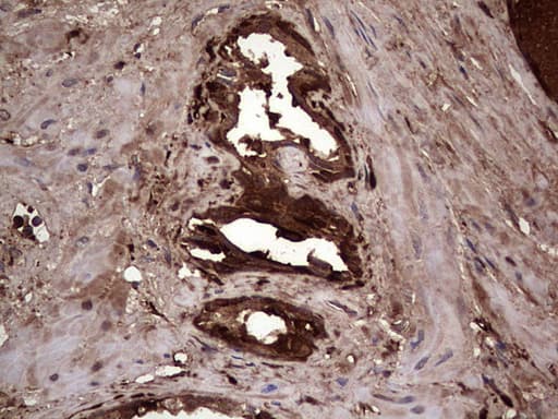 LGALS3 / Galectin 3 Antibody (clone OTI6E1)