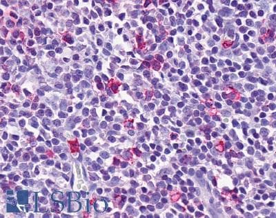 PathPlus™ ADGRE3 / EMR3 Antibody (N-Terminus)