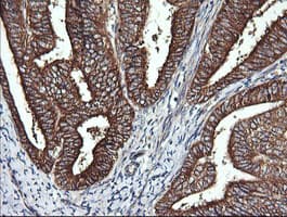 DNM1L / DRP1 Antibody (clone OTI4B5)