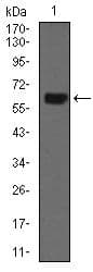 KRT5 / CK5 / Cytokeratin 5 Antibody (Amino Acid: 316-590, clone 10C11E6)