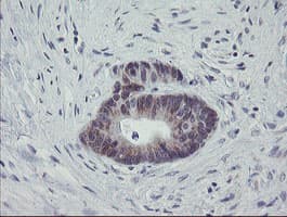 MRPS27 Antibody (aa151-414, clone OTI1A2)