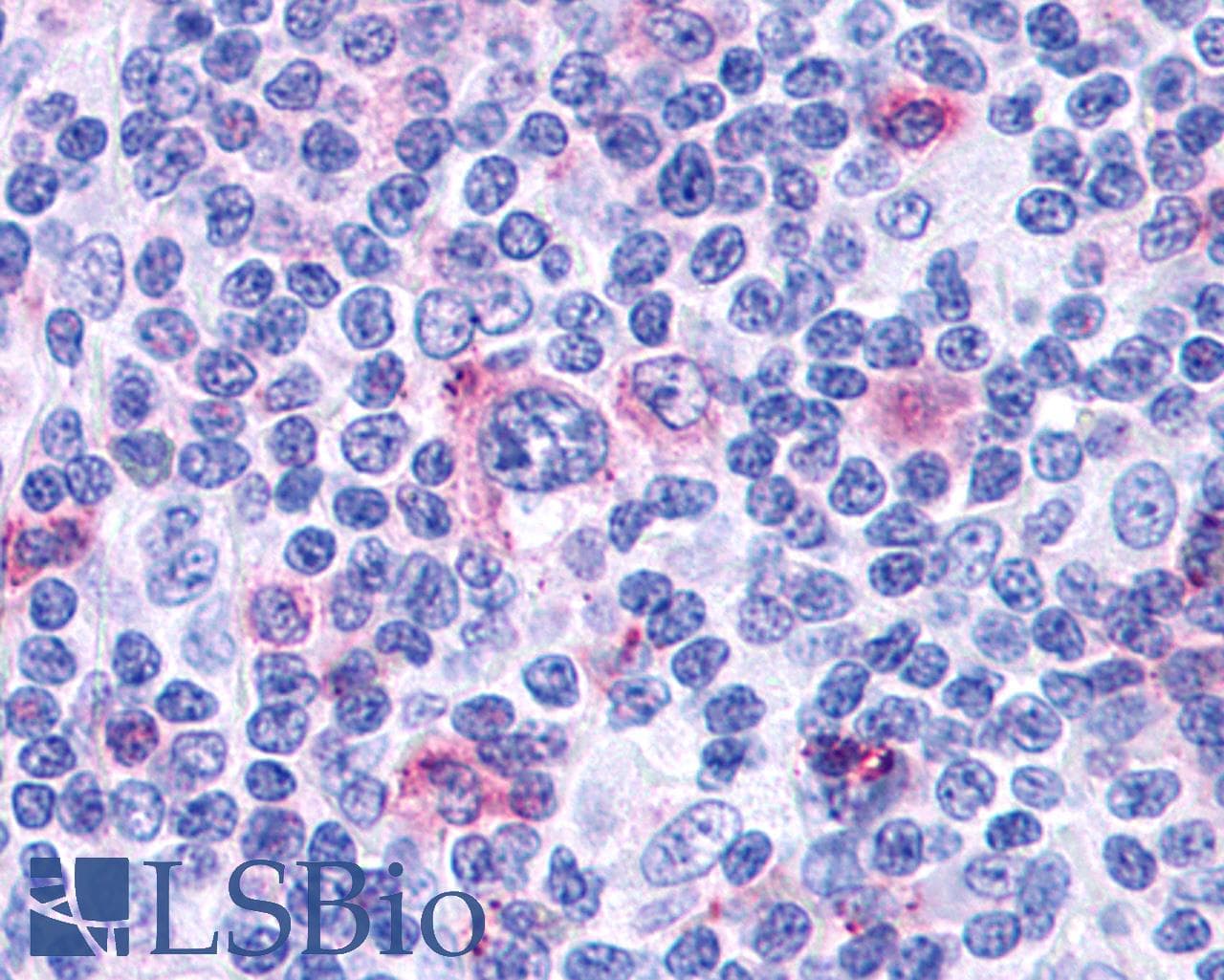 PathPlus™ CCR3 Antibody (Extracellular Domain)