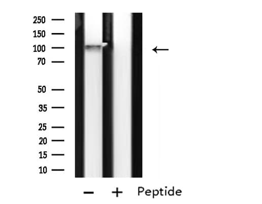 Polyclonal Rabbit anti-Human APOER2 / LRP8 Antibody (IF, WB)