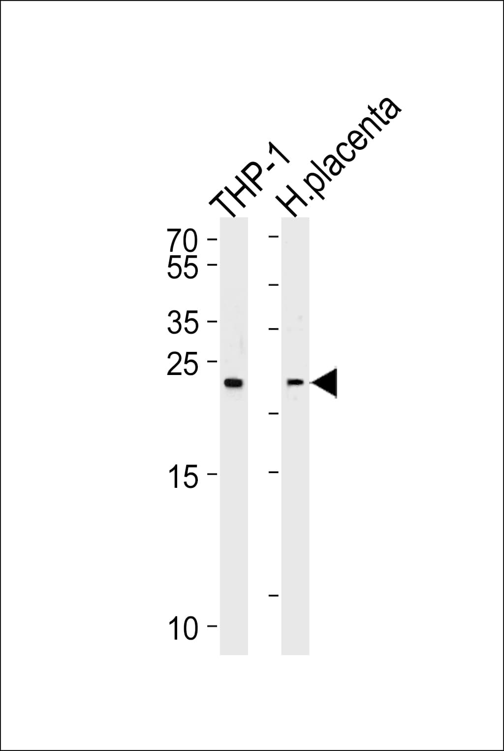 HEBP2 Antibody (aa18-47)