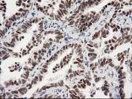 PRKCE / PKC-Epsilon Antibody (clone OTI2A12)