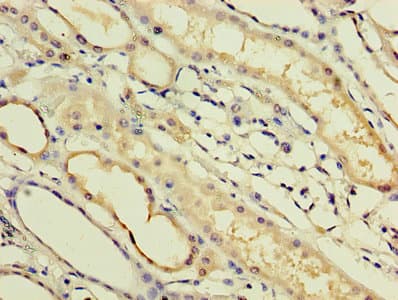 IFNA14 / Interferon Alpha 14 Antibody