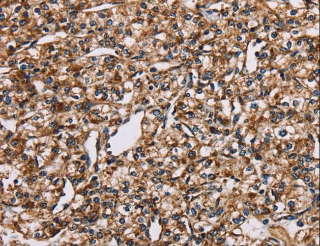 NDUFS1 Antibody