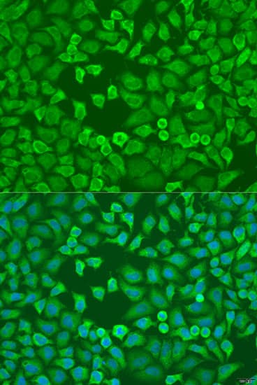 Polyclonal Rabbit anti-Human EIF3A Antibody (IHC, IF, WB)