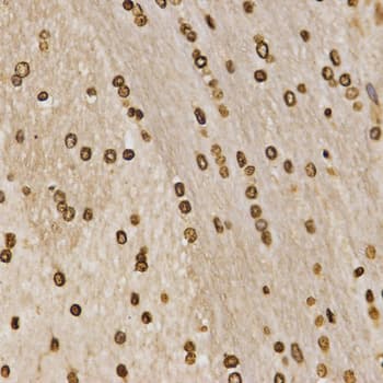 Polyclonal Rabbit anti-Human Histone H3 Antibody (Methyl-Lys27, IHC, IF, WB)
