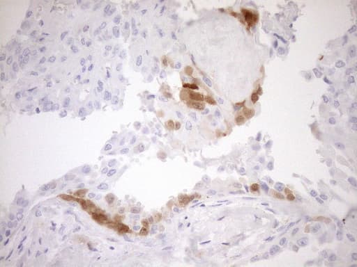 p16INK4a / CDKN2A Antibody (clone OTI5G9)