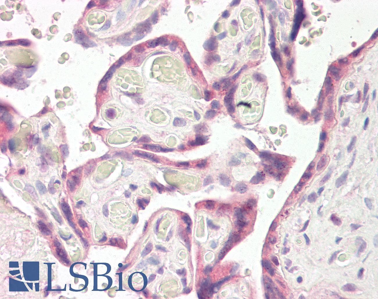 IHC-plus™ Polyclonal Goat anti-Human RNF139 / TRC8 Antibody (aa651-663, IHC, WB)