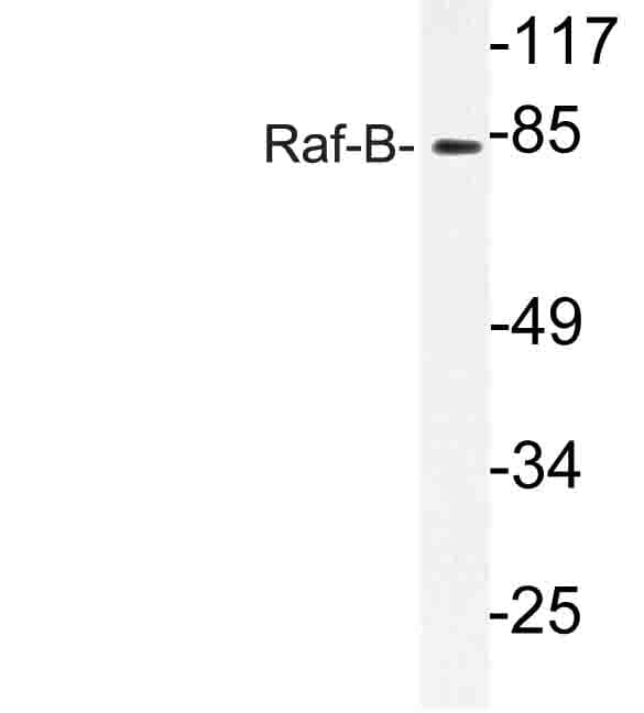 BRAF / B-Raf Antibody (Lys439)
