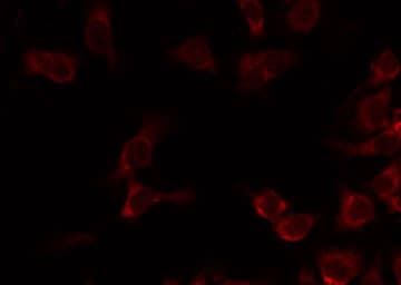 Polyclonal Rabbit anti-Human MRPL20 Antibody (IF, WB)