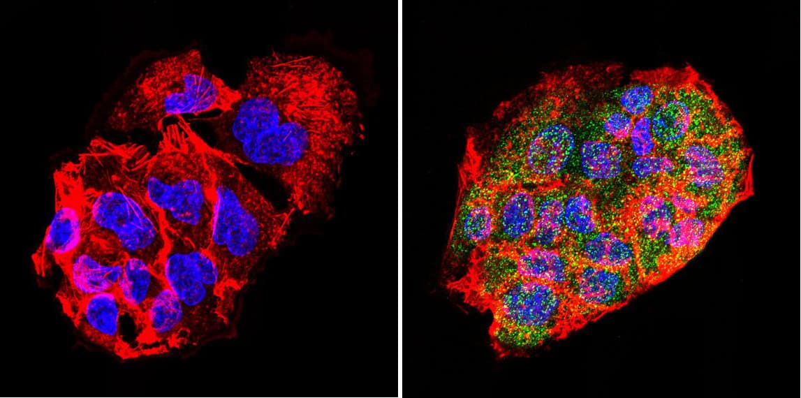 IHC-plus™ Polyclonal Rabbit anti-Human LIN28A / LIN28 Antibody (IHC, IF, WB)