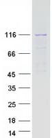 Human UBE3C Protein (Recombinant Myc-DDK (Flag))