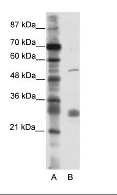 LRRC14 Antibody (aa412-461)