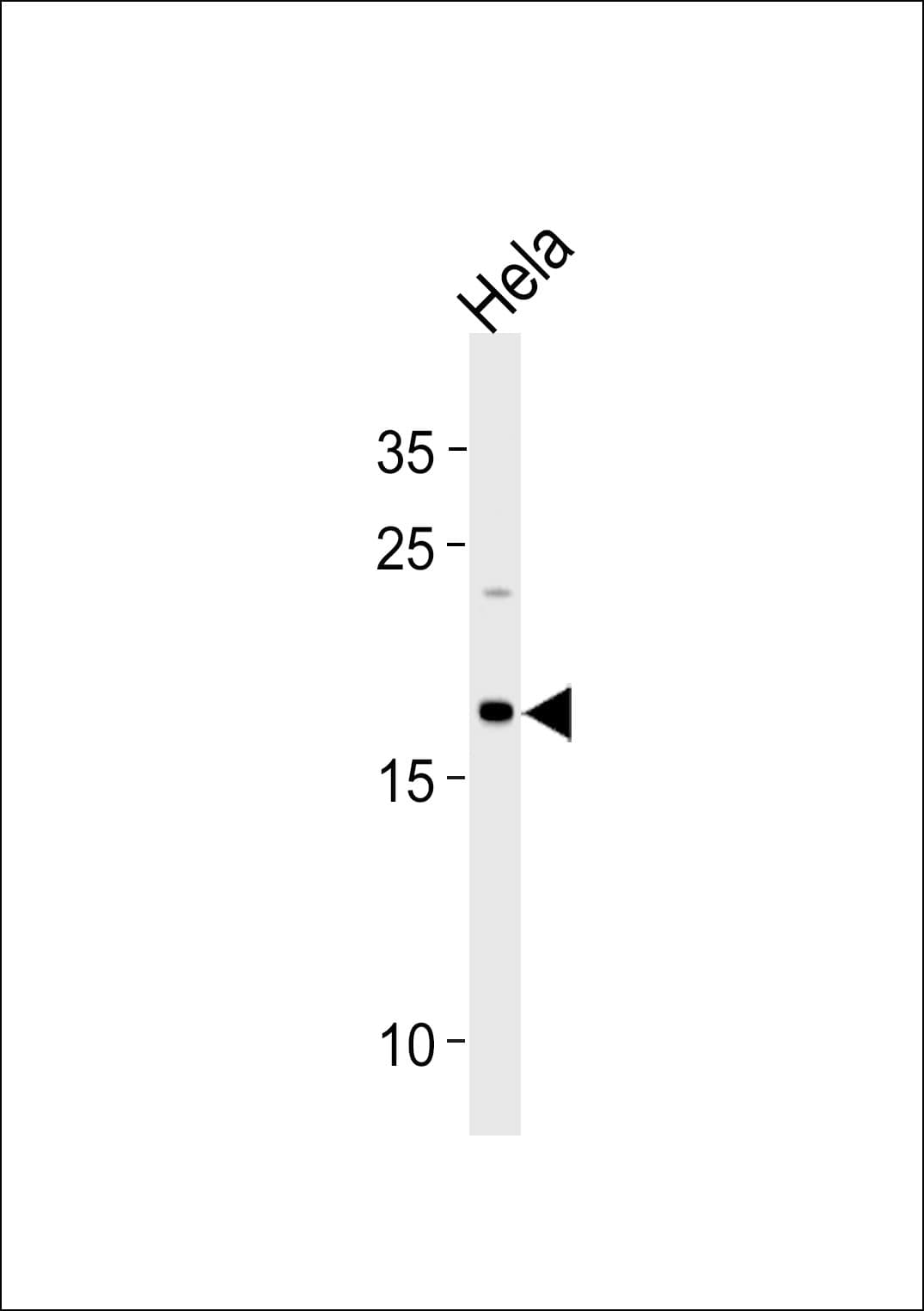 NDUFB10 Antibody (aa43-70)