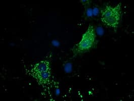 P5CR2 / PYCR2 Antibody (clone OTI2A12, Carrier-free)