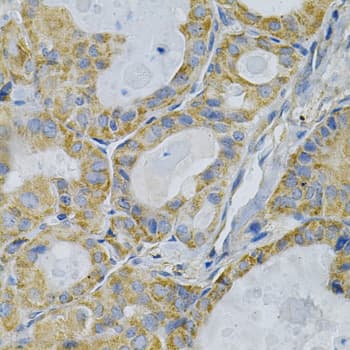 TLR7 / CD287 Antibody