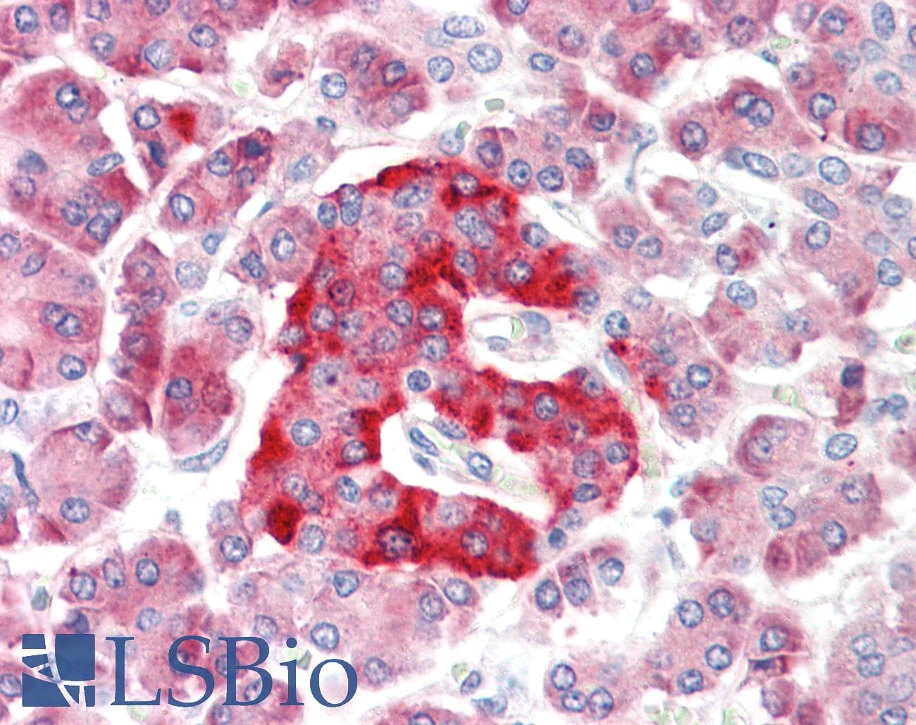 IHC-plus™ Polyclonal Rabbit anti-Human KCNMA1 / BK Antibody (Gln770, IHC, WB)
