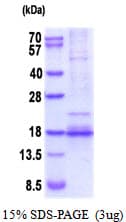 Human BDNF Protein (Recombinant His)