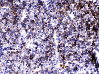 BLC / CXCL13 Antibody