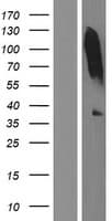 TNMD / Tenomodulin Protein (Over-Expression Lysate Myc-DDK (Flag))