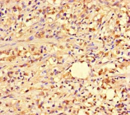 PIF1 Antibody