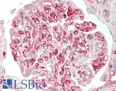 IHC-plus™ Monoclonal Mouse anti-Human Adiponectin Antibody (clone 3D11, aa19-244, IHC, WB)