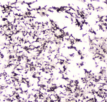 UBE2I / UBC9 Antibody