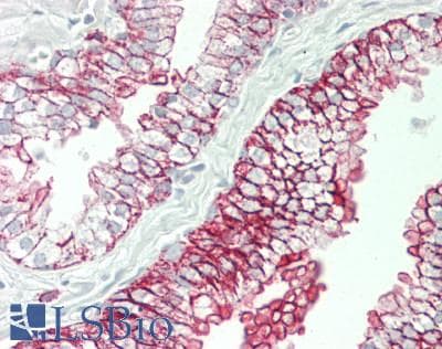 IHC-plus™ Polyclonal Rabbit anti-Human Niban-Like Protein 1 Antibody (aa683-733, IHC, WB)