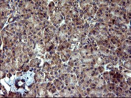 DNM1L / DRP1 Antibody (clone OTI4A4)