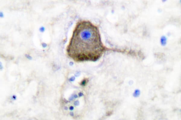 UCHL1 / PGP9.5 Antibody (Arg202)
