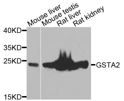 IHC-plus™ GSTA2 Antibody