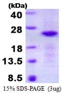 Human CRYGN Protein (Recombinant His)
