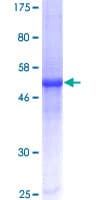 Human CXCL16 Protein (Recombinant GST)